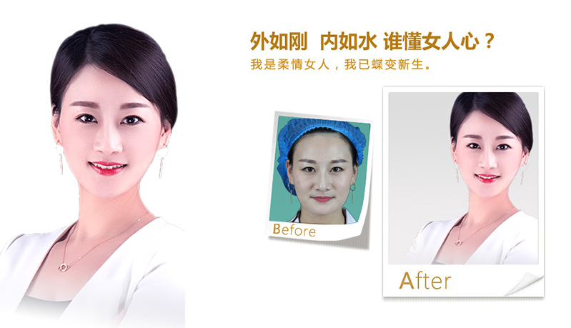 汕尾V脸、线雕隆鼻